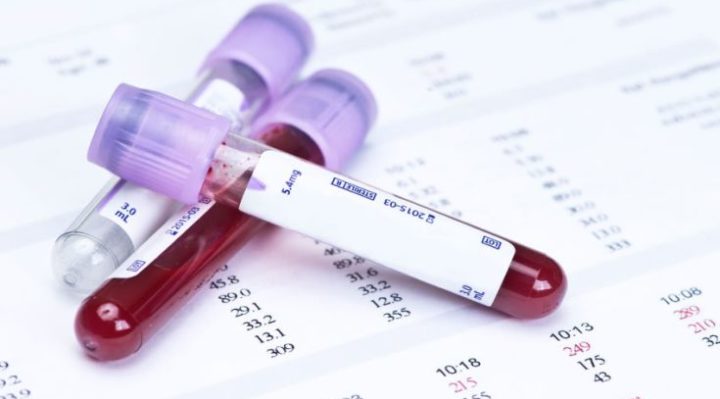 Τεστ αίματος μπορεί να διακρίνει έγκαιρα το Πάρκινσον