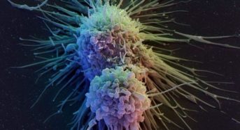 Καρκίνος του ήπατος: Τα οκτώ σημάδια ενός από τους πιο θανατηφόρους καρκίνους
