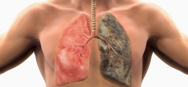 Καρκίνος του πνεύμονα -Πότε εμφανίζονται τα πρώτα συμπτώματα