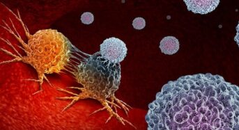 Ανακαλύφθηκε κύτταρο του ανοσοποιητικού που εξοντώνει όλα τα καρκινικά κύτταρα